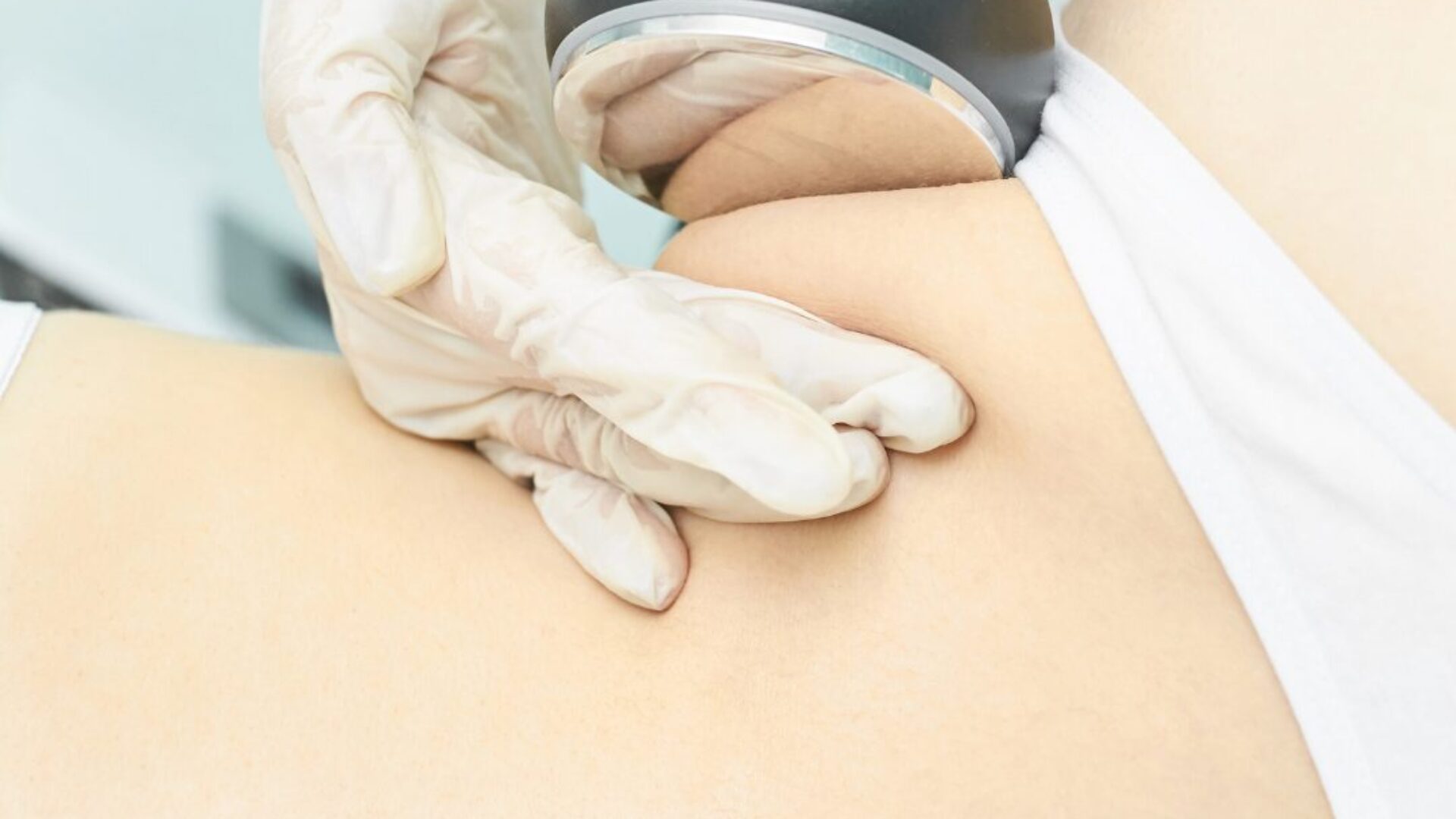 lipocavitação